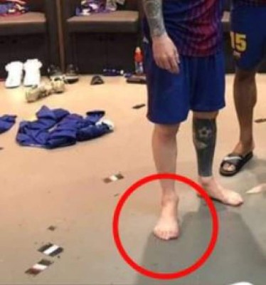 ¿Messi tiene seis dedos en el pie derecho? Imagen del argentino se vuelve viral
