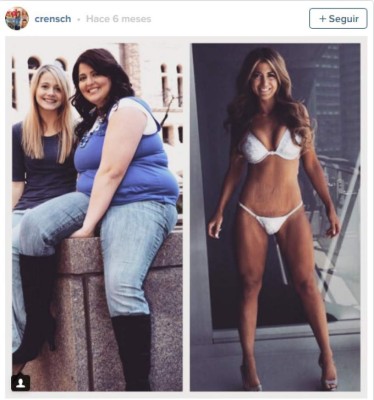 Modelo que luce con orgullo sus estrías se vuelve famosa en EEUU&nbsp;&nbsp;