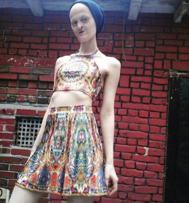 Modelo con inusual apariencia rompe estereotipos de belleza