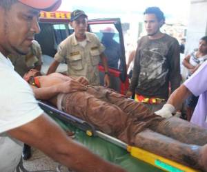 Javier Francisco Posadas fue trasladado al Hospital Escuela Universitario por el Cuerpo de Bomberos. (Fotos: cortesía del Cuerpo de Bomberos)