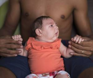 Autoridades de salud investigan los fallecimientos de 46 bebés que presentaron la malformación de nacimiento y que posiblemente están relacionadas al virus del zika.