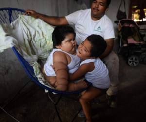 Mario Gonzales se parece a su hijo mayor, Mario (abajo) abraza a su hermano Luis de diez meses en su casa en Tecoman, estado de Colima, México el 8 de noviembre de 2017. Fotos Agencia AFP.