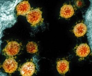 Esta imagen tomada con un microscopio electrónico y proveída y mejorada por el Instituto Nacional de Alergia y Enfermedades Infecciosas de Estados Unidos en Fort Detrick, Maryland, en el 2020, muestra partículas del Coronavirus SARS-CoV-2 aisladas de un paciente. Foto: AP
