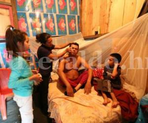 En esta humilde vivienda la familia atiende a Justo Pastor quien urge de atención médica (Foto: Estalin Irías/ El Heraldo Honduras/ Noticias de Honduras)