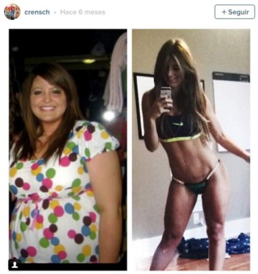 Modelo que luce con orgullo sus estrías se vuelve famosa en EEUU&nbsp;&nbsp;