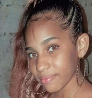Yocairi Rodríguez, la jovencita atacada con ácido por su expareja