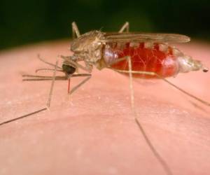 ONG y oposición alertan de aumento de malaria en Venezuela