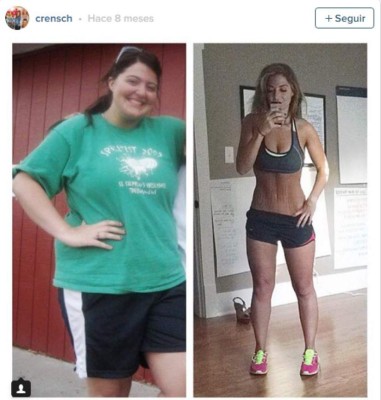 Modelo que luce con orgullo sus estrías se vuelve famosa en EEUU&nbsp;&nbsp;