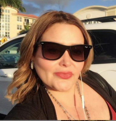 El sorprendente cambio de Sheyla Tadeo tras su drástica pérdida de peso