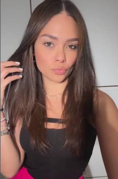 Sirey Morán, presentadora de deportes y su gran cambio tras cirugía estética