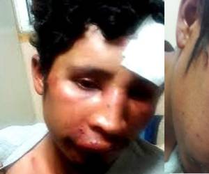 El migrante hondureño quien presenta varios golpes solo fue identificado por Adrián.