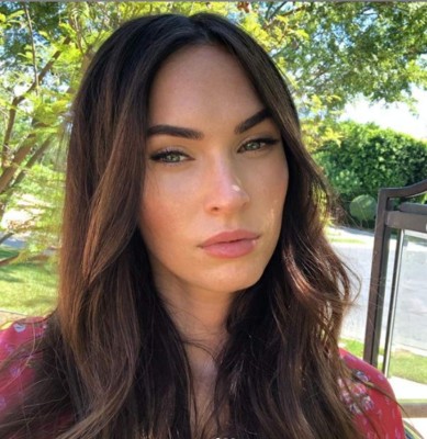 Antes y después de famosos que desfiguraron sus rostros con cirugías