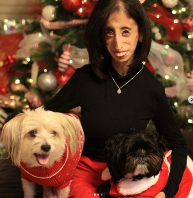 La inspiradora historia detrás de Lizzie Velásquez, la 'mujer más fea del mundo'