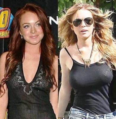 El antes y después de las bubis de las famosas