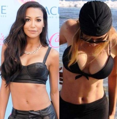 El antes y después de las bubis de las famosas