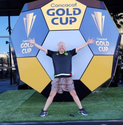 Dan Sur, influencer que asegura que se incrustó cadenas de oro en el cuero cabelludo