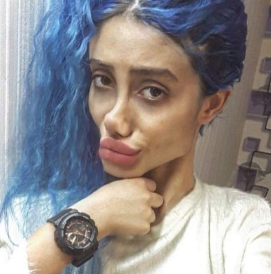 Revelan cómo era el rostro de 'Angelina Jolie zombie' antes de someterse a varias cirugías