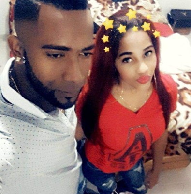 Yocairi Rodríguez, la jovencita atacada con ácido por su expareja
