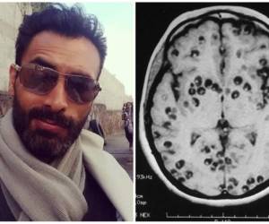 El actor mexicano Sebastián Ferrat murió a causa de esta letal infección.