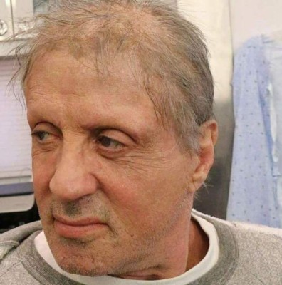 La dramática foto de Sylvester Stallone que causó alarma entre sus fanáticos