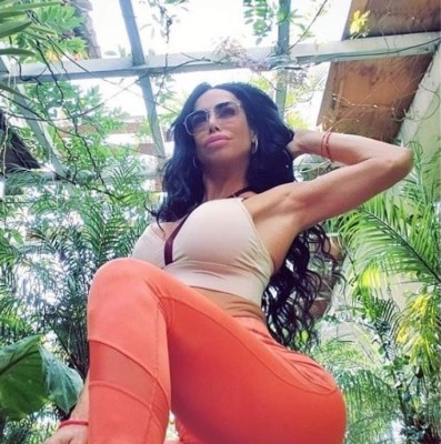 FOTOS: Lis Vega y su radical transformación física tras varias cirugías