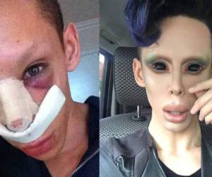 Vinni Ohh, de 22 años, es un joven transformista de Los Ángeles que se ha sometido a varias operaciones para lograr su sueño de parecer extraterrestre (Foto: Instagram)