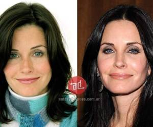 La actriz Courtney Cox es confesa amante del botox, dice utilizarlo con moderación y que hace sentirla bien consigo misma.