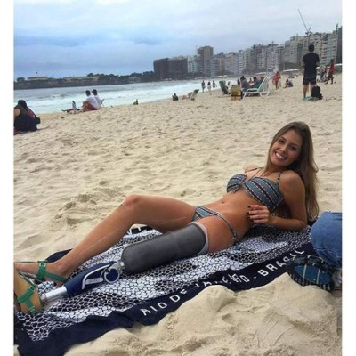 Hermosa modelo sin una pierna arrasa en las redes sociales