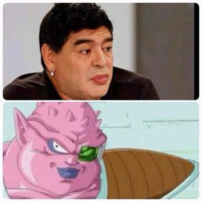 Maradona se opera los labios y revoluciona las redes