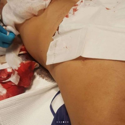 Pandilleros apuñalan a Mala Fe, cantante de 'La vaca', en Nueva York