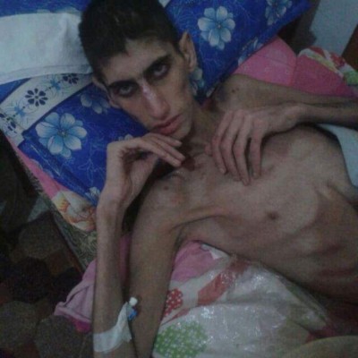 Madaya la ciudad del hambre