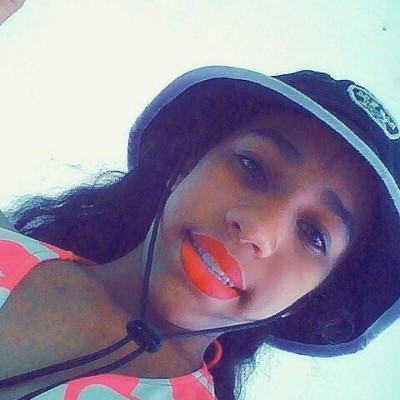 Yocairi Rodríguez, la jovencita atacada con ácido por su expareja