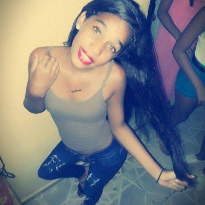 Yocairi Rodríguez, la jovencita atacada con ácido por su expareja