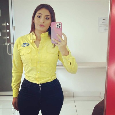 Así luce Rina Leal tras someterse a procedimiento estético   