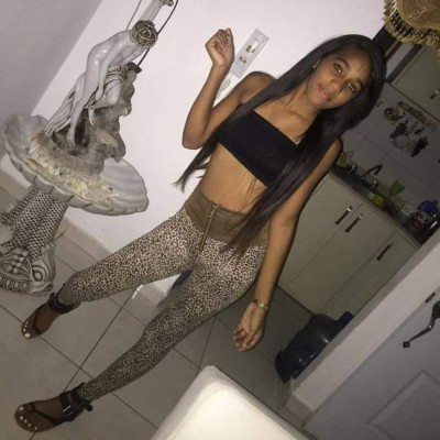 Yocairi Rodríguez, la jovencita atacada con ácido por su expareja