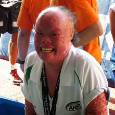 Escondió su rostro por 22 años