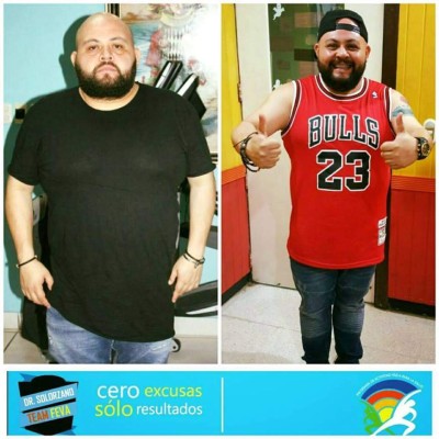 Fotos: Hondureños que han experimentado una drástica pérdida de peso; lucen irreconocibles