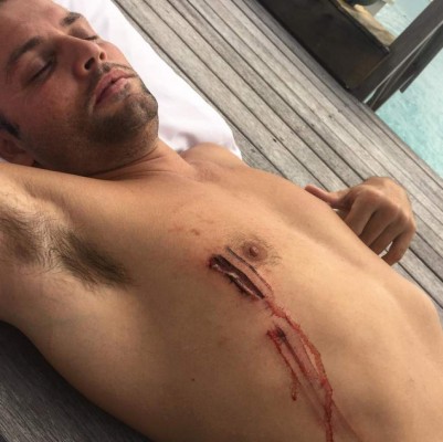 Justin Bieber sufrió un ataque de tiburón