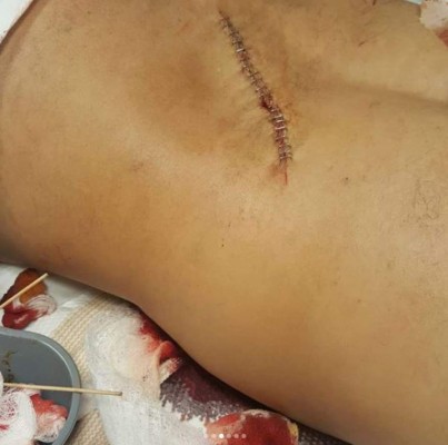 Pandilleros apuñalan a Mala Fe, cantante de 'La vaca', en Nueva York