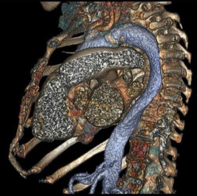 El cuerpo humano por dentro como nunca lo has visto