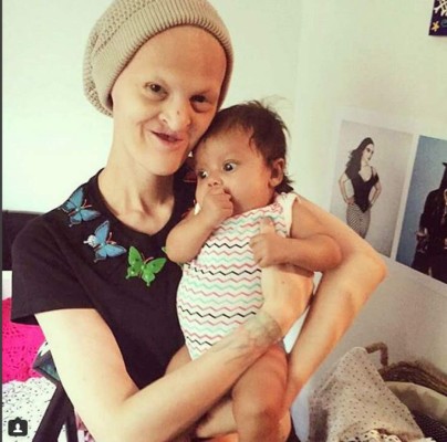 Modelo con inusual apariencia rompe estereotipos de belleza