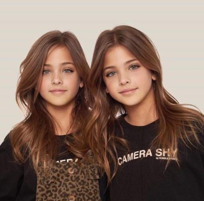 FOTOS: Los datos que debes saber sobre las gemelas más bellas del mundo