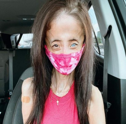 La inspiradora historia detrás de Lizzie Velásquez, la 'mujer más fea del mundo'