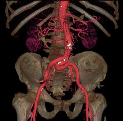 El cuerpo humano por dentro como nunca lo has visto