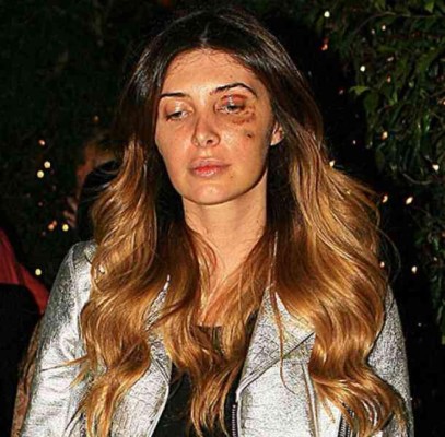 Golpean a sexy exnovia de Luis Miguel