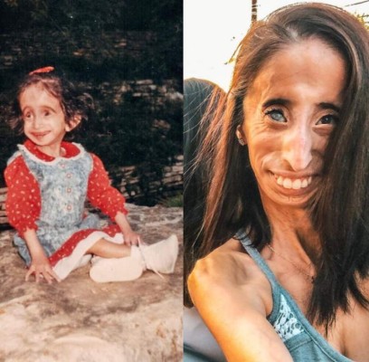 La inspiradora historia detrás de Lizzie Velásquez, la 'mujer más fea del mundo'