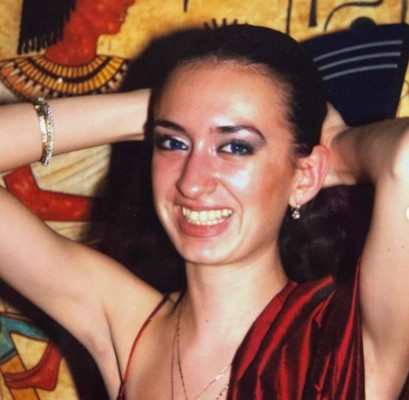 Anastasia Pokreshchuk, la mujer con los pómulos más grandes del mundo (FOTOS)