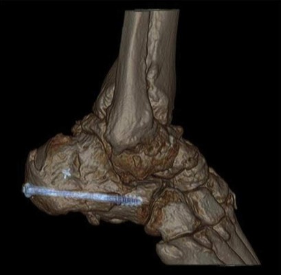 El cuerpo humano por dentro como nunca lo has visto