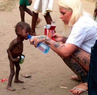 'Hope”, el niño desnutrido que se escapó de las garra de la muerte en África
