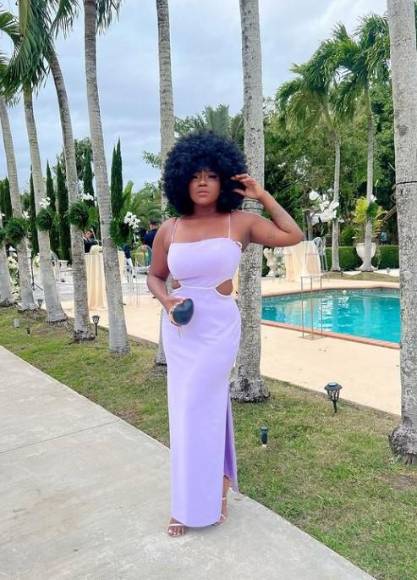 El increíble cambio físico de la Chiky Bombom tras someterse a bypass gástrico